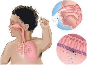 Ребенку два года лающий кашель thumbnail