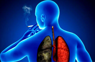 Хронический кашель: причины и лечение
